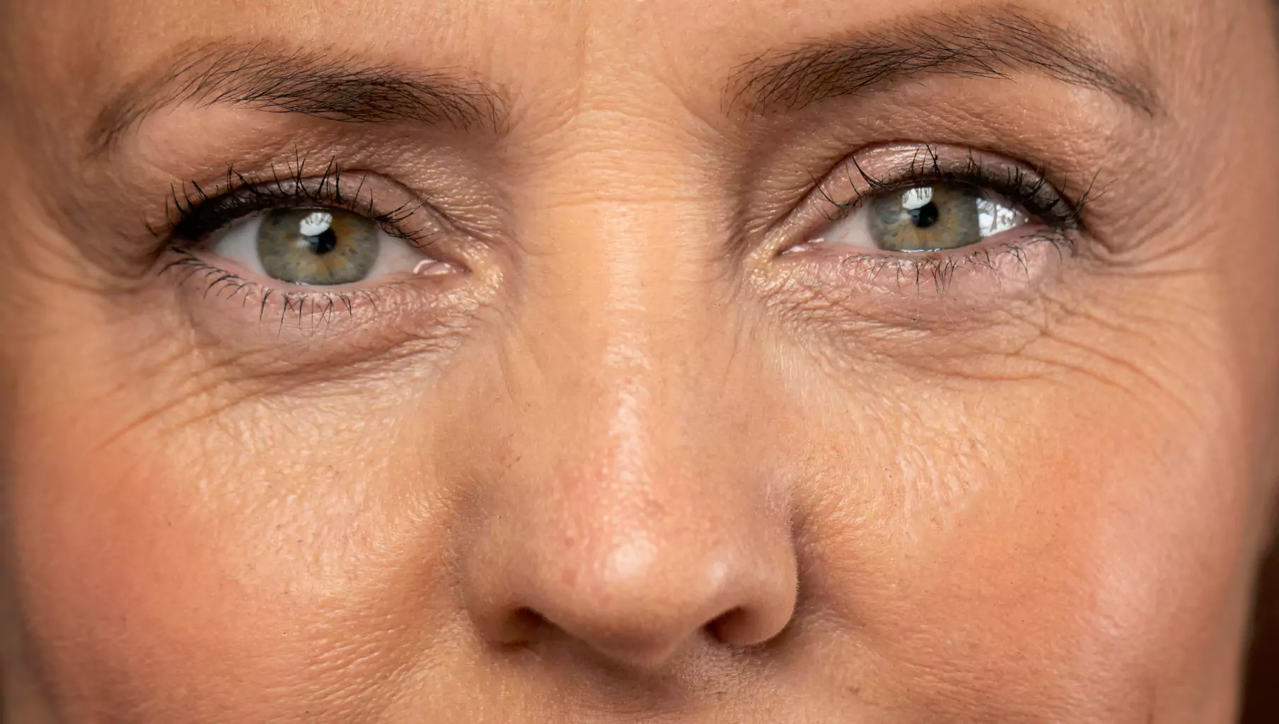 Crow’s Feet: Ageing With A Smile